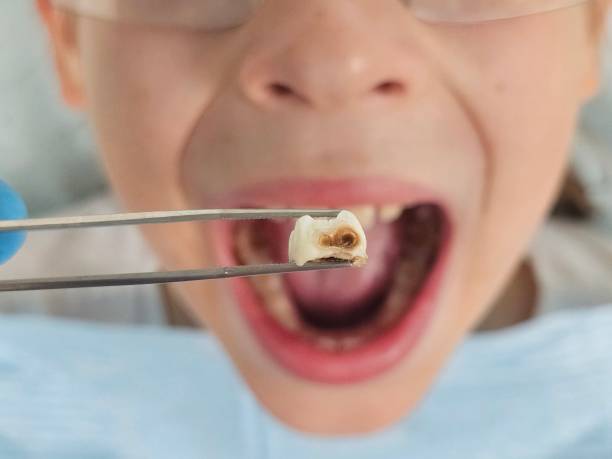 Best Dentist for Dental Trauma  in Pleasant Hill, TX